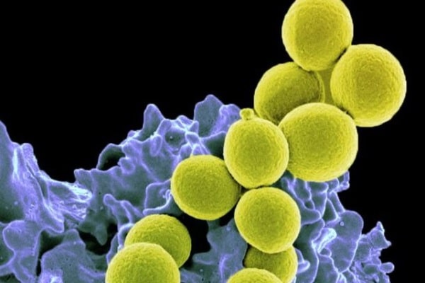 Estudo revela mecanismo para disseminação de resistência a antibióticos entre bactérias